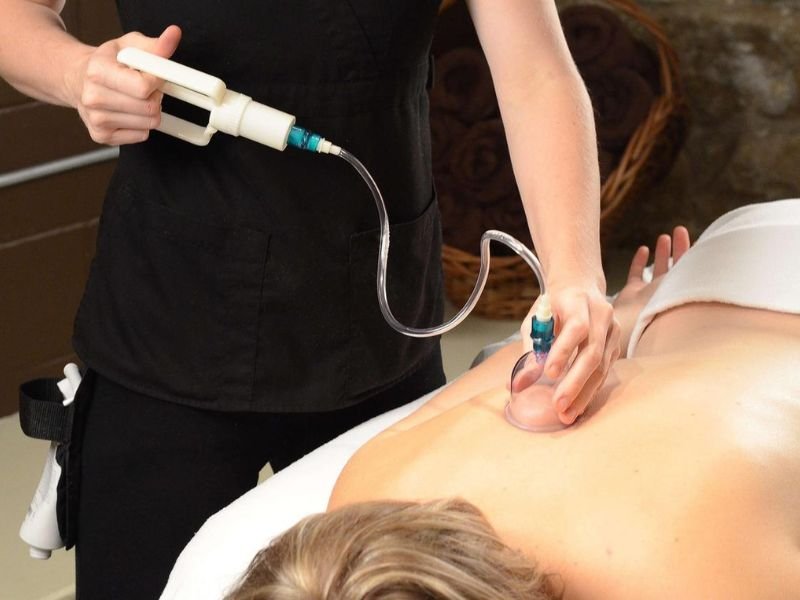 Cupping Therapy